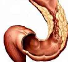 Debelog crijeva adenokarcinom