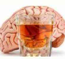 Alkoholna encefalopatija