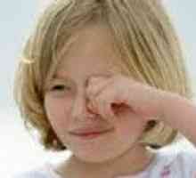 Alergijskog konjunktivitisa kod djece