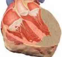 Srčani amiloidoza