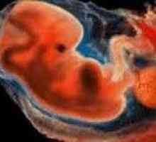 Fetalne smrti
