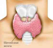 Autoimuni tiroiditis (Hashimoto tiroiditis)