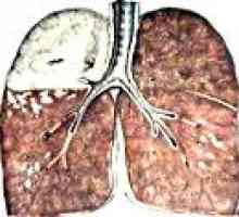 Bakterijska pluća uništenje