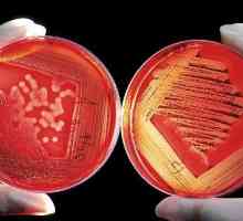 Bakterijski šok u uroloških bolesti