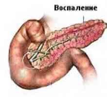 Bilijarna pankreatitis