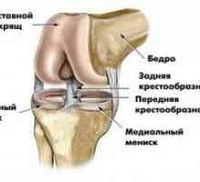 Bol u zglobu kolena