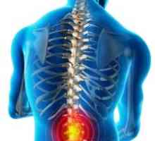 Bol u leđima: uzroci, liječenje