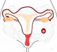 Abdominalna trudnoća