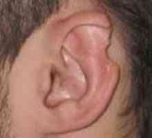Deformacije uši