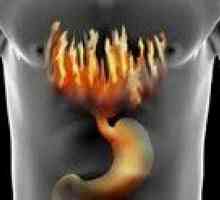 Gastritis s visokim kiselost