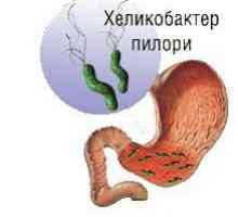Gastritis: uzroci, simptomi, liječenje, dijeta