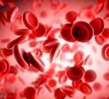 Hemolitičke anemije