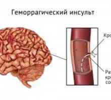 Hemoragijski moždani udar