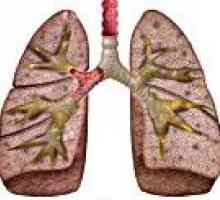 Hronične upale pluća