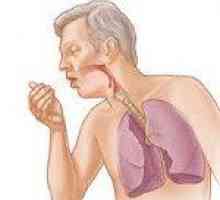 Hronični bronhitis