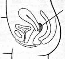 Strano tijelo vagina