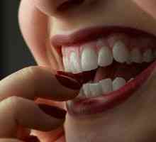 Korekcija zuba (okluzija) bez zagrada