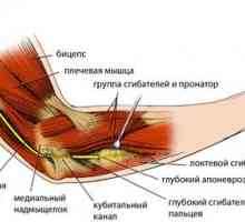 Endoskopska tretman kompresije sindroma ulnarnog živca