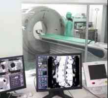 Kompjuterska tomografija (CT tomografija), X-ray