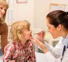 Tretman infektivne mononukleoze kod djece