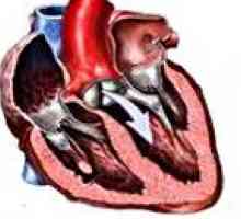Mitralni i aorte defekt