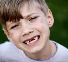 Mlijeko zuba u djece i njihovih promjena
