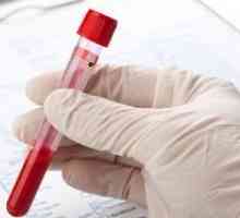 Niska hemoglobina (anemija)