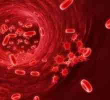 Nizak krvni broj trombocita: uzroci, simptomi, liječenje