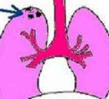 Focal plućne tuberkuloze
