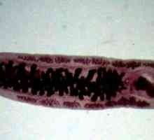 Opisthorchiasis (Vinogradov bolest)
