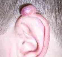 Tumori uha