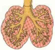 Malformacije razvoja pluća