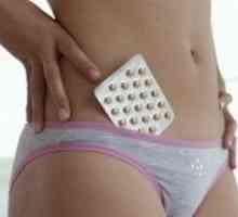 Postpartalna kontracepcija