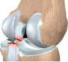 Oštećenja na koljena ligamenata