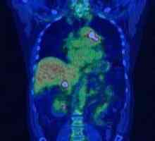 Pozitronske emisijske tomografije (PET)