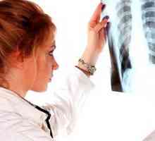 Simptomi raka pluća u ranoj fazi