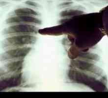 Rak pluća