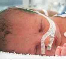 Generic neonatalne ozljede