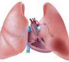 Kardio-plućne insuficijencije
