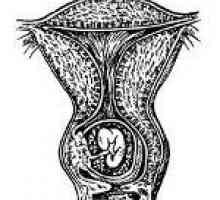 Cervikalna trudnoća