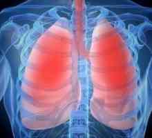 Simptomi bronhitisa kod odraslih