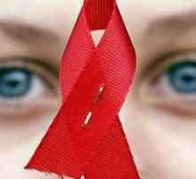 Simptomi HIV-a