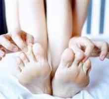 Sindrom nemirnih nogu (džip bolest ekboma bolest)