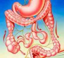 Sindrom iritabilnog crijeva (IBS)