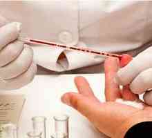 Sklonost ka altsgymera bolesti odrediti test krvi