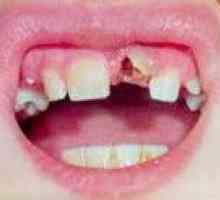 Dentalne traume