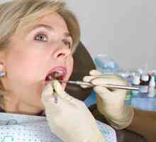 Uklanjanje zubnog kamena ultrazvukom