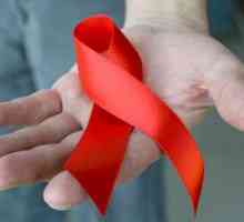 HIV infekcije i AIDS-a