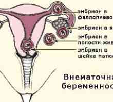 Vanmaterične trudnoće
