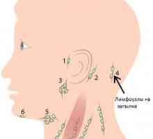 Otečene limfne čvorove u potiljak